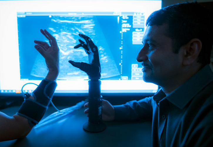 Siddhartha Sikdar in the lab with a prosthetic Siddhartha Sikdar in the lab with a prosthetic
